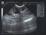 Ultrasounds Jaris December 11, 2009