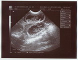 Ula Ultrasounds 28 April 2011